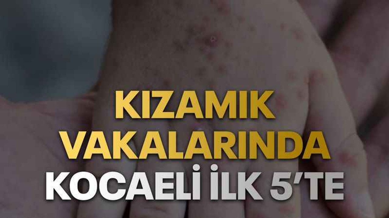 Kızamık vakalarında Kocaeli ilk 5’te